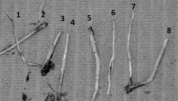 Figura 4 Conos de gutapercha de diferente diámetro y longitud Fuente propia