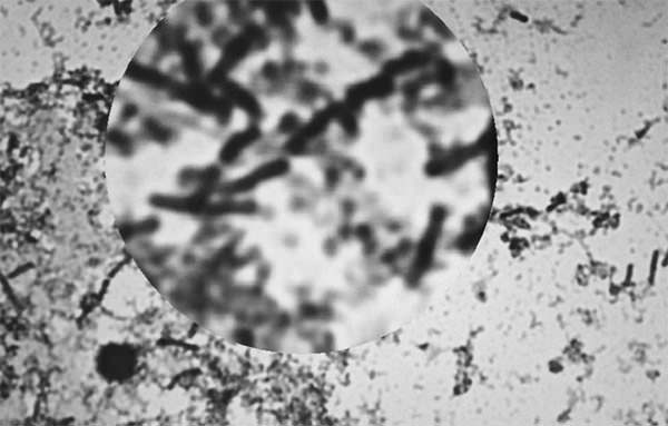 Figura 5 Fotografía microscópica de colonias de Escherichia coli Fuente: Propia