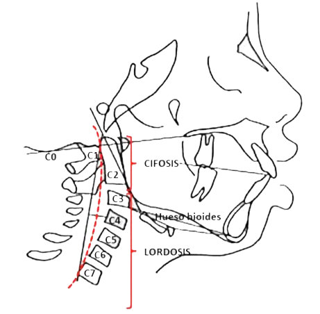 Fig. 1: Cifosis y lordosis de la columna cervical.