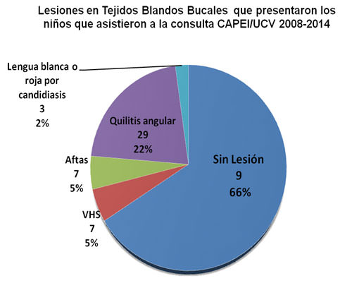 Gráfico No.2 Distribución de acuerdo a las lesiones en tejidos blandos bucales observadas en los niños VIH/SIDA que asisten de manera regular al CAPEI/UCV durante el periodo 2008-2014