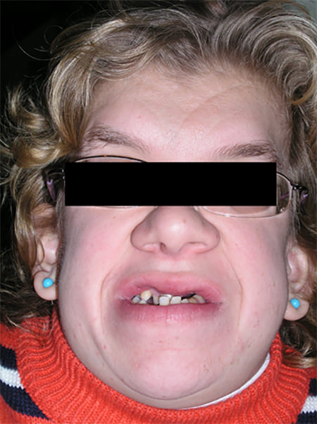 Fig 1.