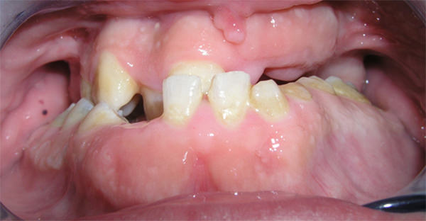 Fig 2.