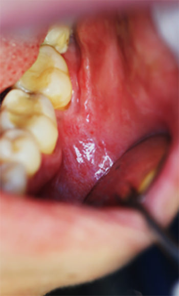 Fig. 5 Control post operatorio