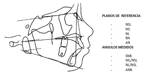 Figura 6 Planos y Ángulos de referencia para el análisis cefalométrico de Lavergne Petrovic Tomado de Guercio 2009 19