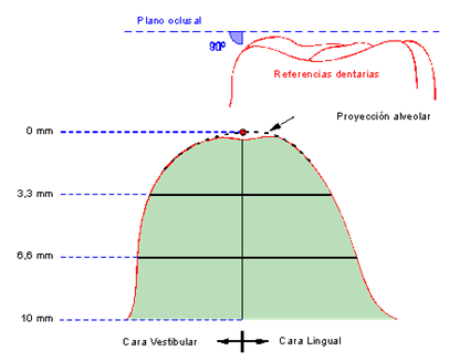 Fig 4 Detalle de zonas delimitadas en sección alveolar en sentido transversal.