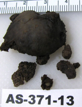 Fig. 1 Descripción macroscópica: espécimen constituido por múltiples fragmentos; uno mayor de 2.9 x 1.8 x 0.5 cm, morfología irregular, superficie rugosa, bordes asimétricos, color hemático o negruzco, aspecto acartonado, consistencia arenosa.