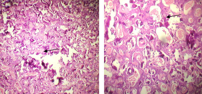 Fig. 3 y 4 Trabéculas de hueso con diferentes grados de mineralización en un fondo de tejido conjuntivo marcadamente vascular. (4X y 20X respectivamente)