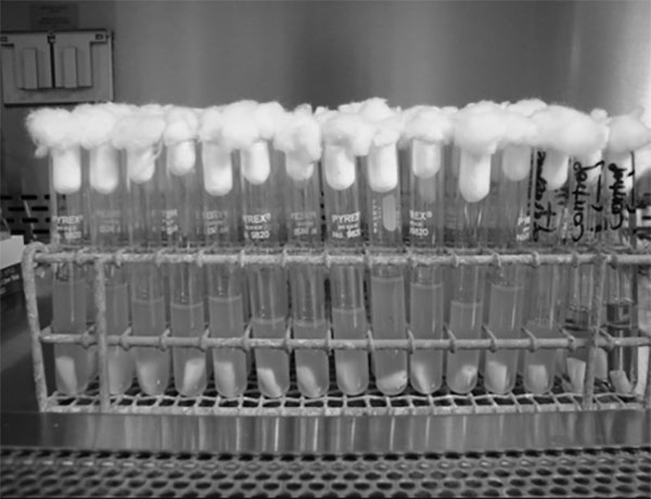 Foto 1 Unidades dentarias sumergidas en caldos BHI con cepa de Enterococcus faecalis