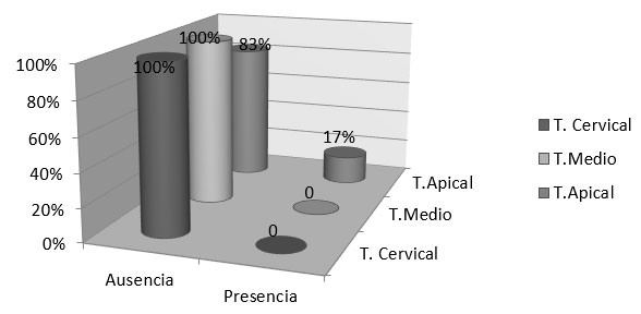 Gráfico 2 Técnica Ultrasónica Pasiva