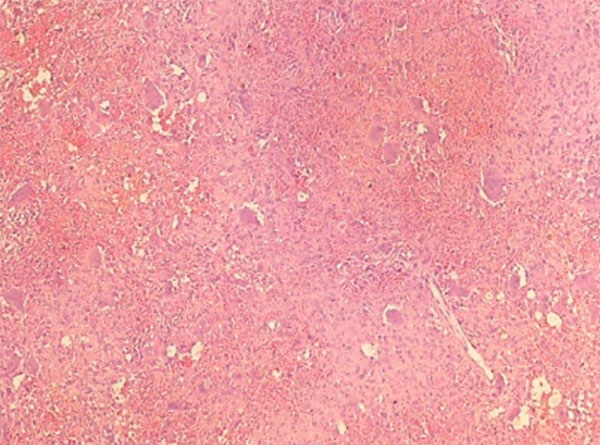 Foto microscópica a menor aumento de la muestra