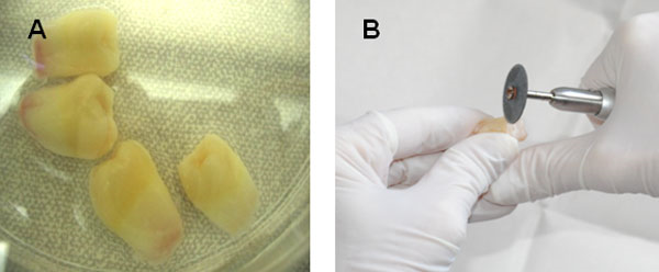 FIGURA 1 Terceros molares incompletamente formados recién extraídos.A) Después de la limpieza y desinfección de la superficie dentaria, realizada en la campana de flujo laminar horizontal; B) Confección del surco, 1 mm por debajo de la unión cemento-esmalte