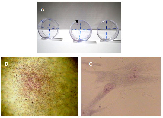 FIGURA 3 Cultivo de células mesenquimales de pulpa dentaria humana a baja densidad, por 14 días, para la prueba de EFC. A. Placas de 35 mm (8,8 cm2), por triplicado. Se observan numerosas colonias coloreada con Giemsa (flecha) B. Formación de colonia con numerosas células fibroblásticas > 50. 25x. C Mayor detalle de las células, típicas de fibroblastos, fusiformes, un citoplasma claro con extensiones citoplasmáticas, un núcleo ovalado, central y varios nucléolos, 400x.