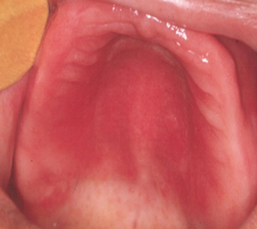 Figura 1