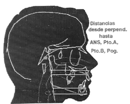 Fig. 2 Distancias hasta : ANS, pto.A, B, Pg,