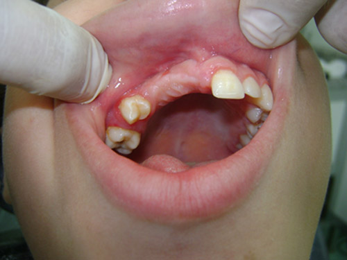 Figura 4 Aspecto oral de 90 días post-operatorio