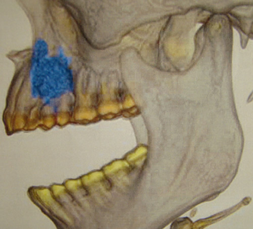 Figura 3