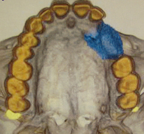 Figura 4