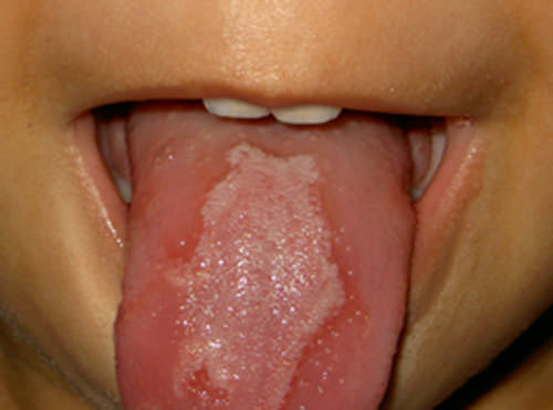 Foto 4 Lengua geográfica