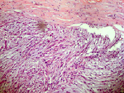 Fig.4 Fibras musculares lisas y vasos sanguíneos