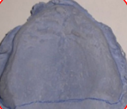 Figura 10