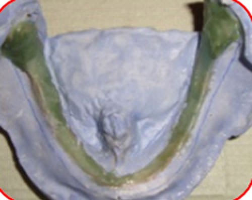 Figura 13