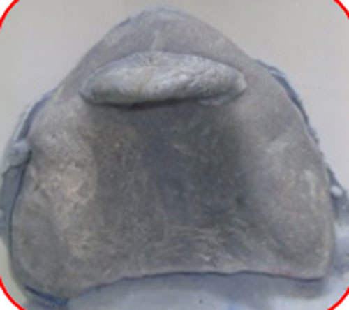 Figura 14