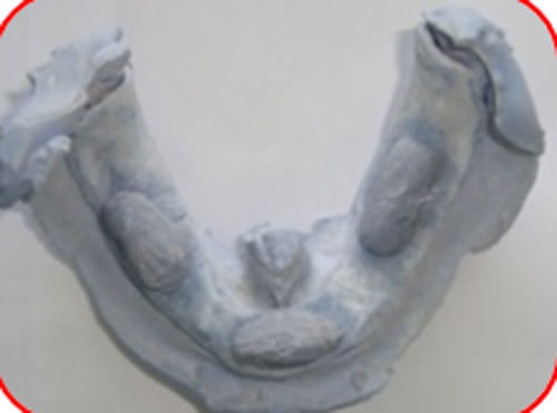 Figura 15