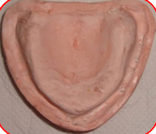 Figura 20