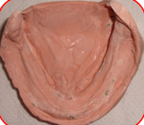 Figura 21