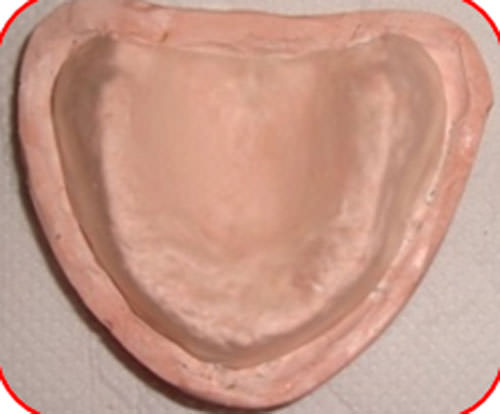 Figura 22