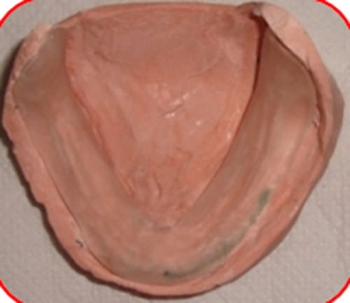 Figura 23