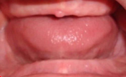 Figura 3