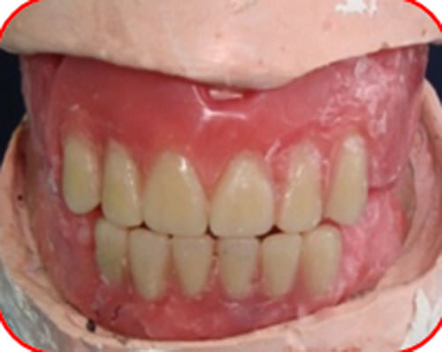 Figura 35