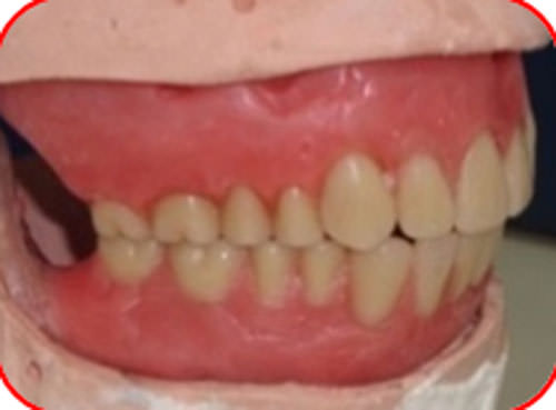 Figura 37