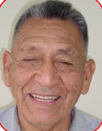Figura 43