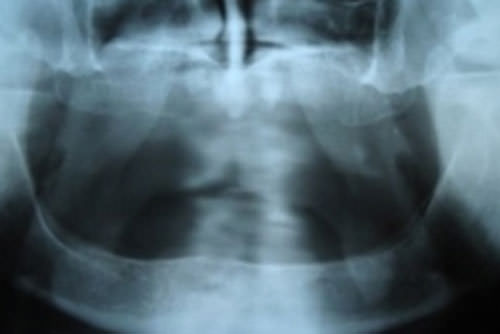 Figura 6