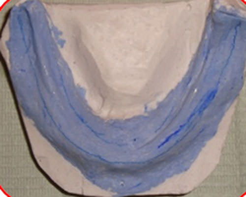 Figura 8