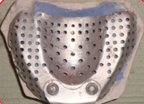 Figura 9