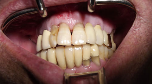 Fig. 1 Foto clínica preoperatoria