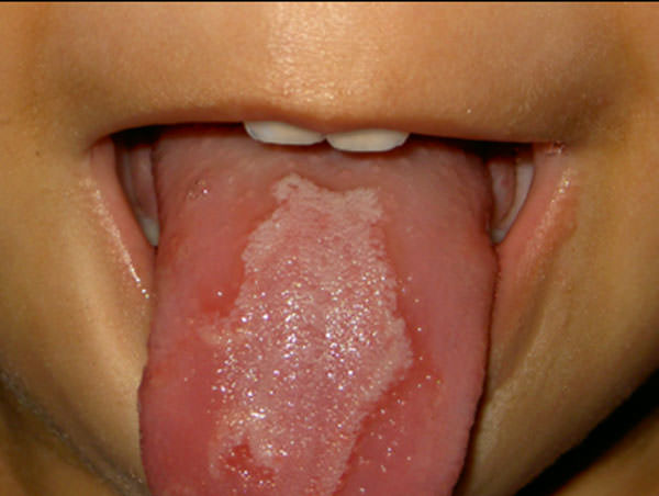 Foto 4 Lengua geográfica