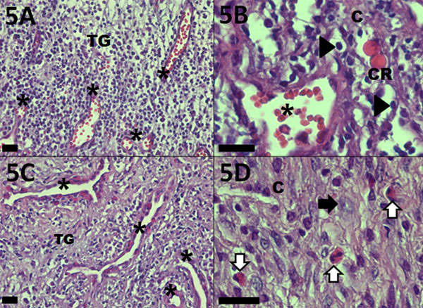 Figura 5 Análisis histopatológico del granuloma periapical. Región central de la lesión: A - Tejido de granulación (TG) con abundantes vasos sanguíneos (*) y poco depósito de colágeno (C). B - Infiltrado inflamatorio mononuclear: linfocitos (cabezas de flecha) y plasmocitos que contienen inmunoglobulinas no segregadas o cuerpos de Russell (CR) en región perivascular (*). Periferia de la lesión: C - Tejido de granulación (TG) con abundantes vasos sanguíneos (*) y aunento de la deposición del colágeno (C). D - Eosinófilos (flechas blancas) y fibroblastos (flecha negra). Las barras de medida representan 25µm.