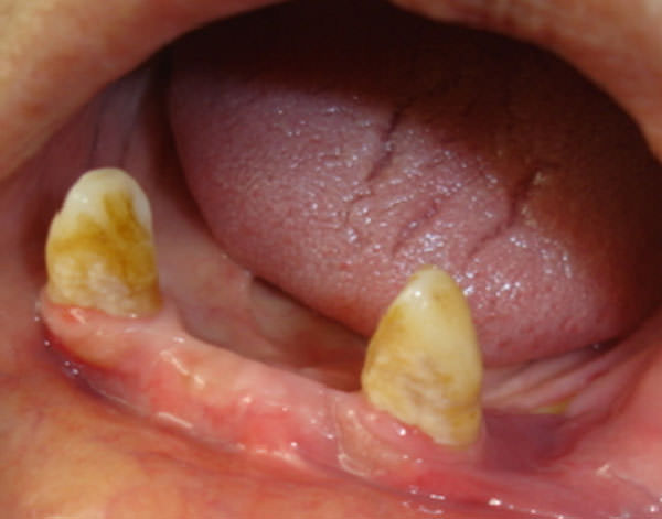 Fig. 1 Examen Clínico intrabucal. Tomada de caso clínico Profa. Martha Espinoza