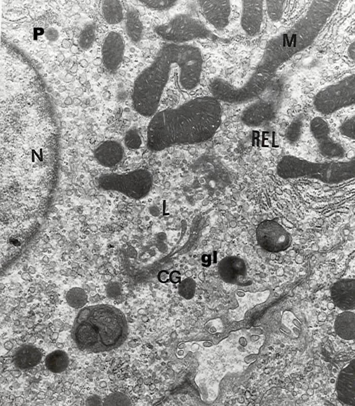 FIG. 1.-Sección de un hepatocito de rata alimentada con una dieta enriquecida con aceite de pescado al 10% (p/p). Las mitocondrias (m) son alargadas. En la matriz se observan las crestas hinchadas y una elevada densidad electrónica. L: lisosoma, cg: complejo de Golgi, rel: retículo endoplasmático liso, p: peroxisoma. gl: Gránulo de lipofucsina x27.000