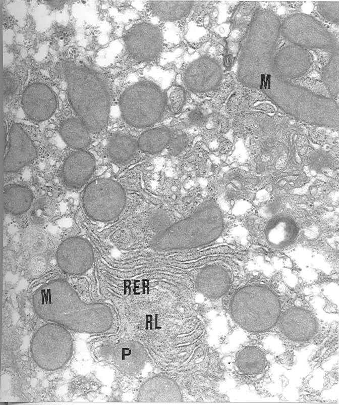 Fig. 2.-Hepatocito de una rata hipertiroidea. Las mitocondrias (m) muestran una matriz casi homogénea y las membranas presentan una elevada densidad electrónica. Note el arreglo del retículo endoplasmático rugoso (rer) y la presencia de numerosos ribosomas libres (rl). p: peroxisoma. x37.000.