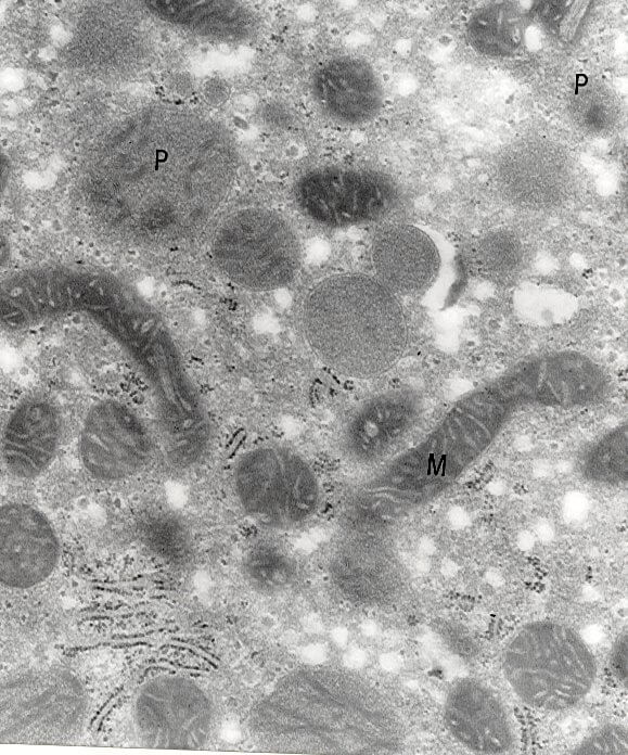 Fig. 3.-Hepatocito de una rata alimentada con una dieta enriquecida con aceite de pescado al 10% (p/p) y tratada con T4. Las mitocondrias (m) muestran una forma alargada, con crestas hinchadas y una elevada densidad electrónica en su matriz. Algunos peroxisomas (p) presentan una estructura paracristalina en la matriz. x30.000.