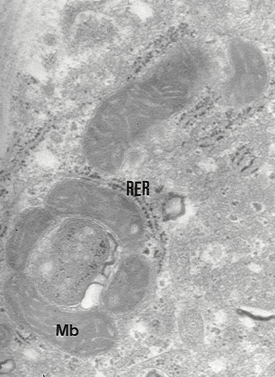 Fig. 4.-Mitocondrias del hepatocito de ratas alimentadas con una dieta suplementada con aceite de pescado al 10% (p/p) y tratadas con T4. Mitocondrias bizarras (mb) parecidas a las de la Fig.1 dispuestas en un arreglo circular. rer: retículo endoplasmático rugoso. x56.000.
