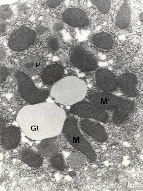 Fig. 5.-Las mitocondrias (m) del hepatocito de ratas alimentadas con aceite de pescado aparecen asociadas a peroxisomas (p) y gotas de lípidos (gl). x27.000