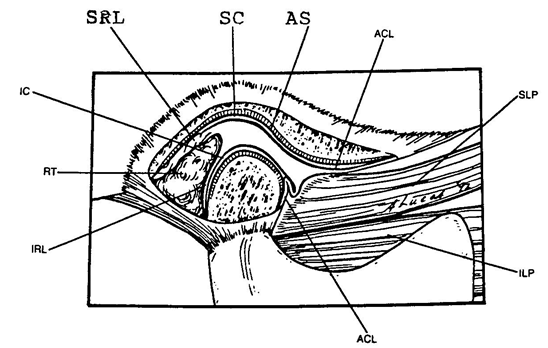 Figura 1: Anatomía Normal de la Articulación Temporomandibular Vista lateral de la articulación Temporo-mandibular: Componenetes: RT: Tejido Retrodiscal, SRL: Lámina Retrodiscal Superior, IRL: Lámina Retrodiscal Inferior, ACL: Ligamento Capsular, SLP y ILP: Pterigoideo superior e inferior, AS: Superficie articular, SC e IC: Espacios Cavitarios Superior e Inferior.  (Tomado de J.P. Okeson. Management of Temporomandibular Disorders and Occlusion)