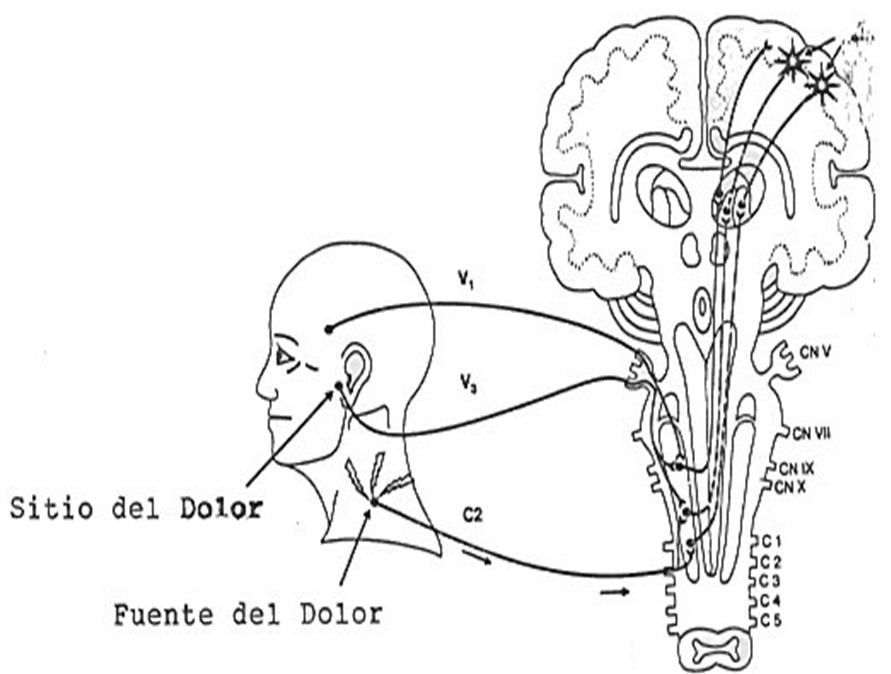 Figura 5: Diferencia entre dolor primario y dolor heterotópico en la articulación Temporomandibular (Tomado de J.P. Okeson. Management of Temporomandibular Disorders and Occlusion)