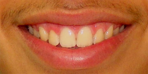 Foto 10 Foto de sonrisa